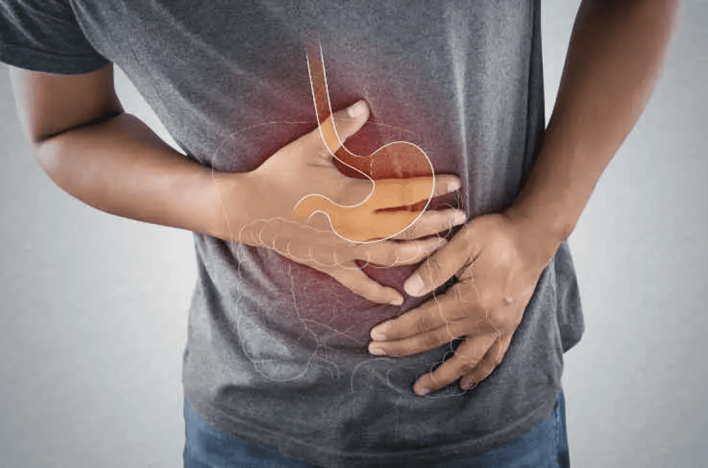 Inflammatory Bowel Disease